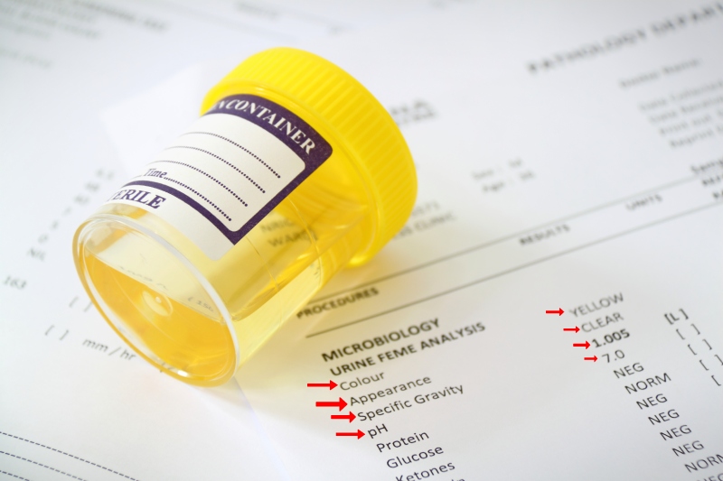 does synthetic urine work for passing a drug test with correct specific gravity appearance ph